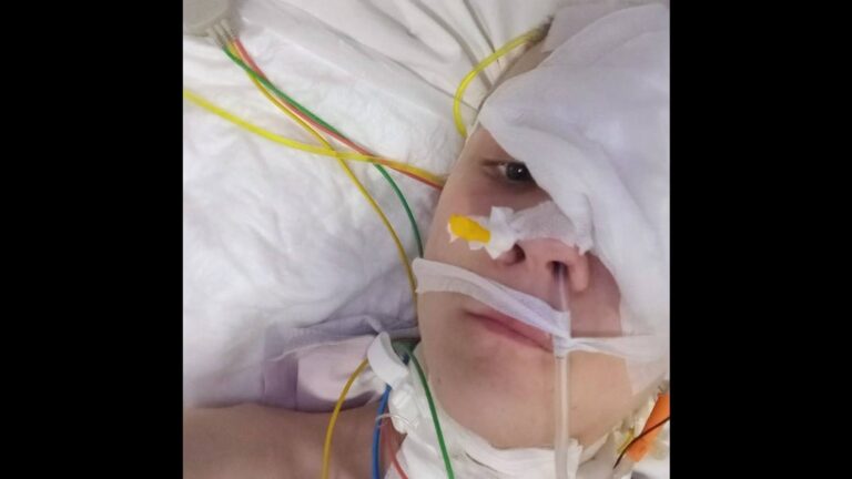 Львівські лікарі: як звичайна застуда може призвести до небезпечної операції врятувавши життя підлітка 2