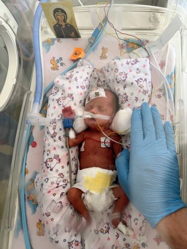 Крихітна принцеса з Львівщини: як медики подарували життя дитині, що важила як обручка 2