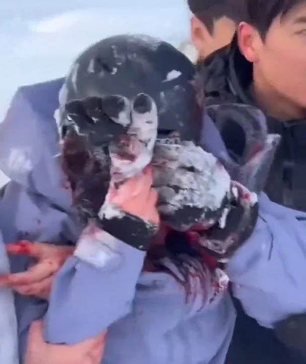 Селфі з білим хижаком: як прогулянка в Китаї обернулася смертельною небезпекою 7