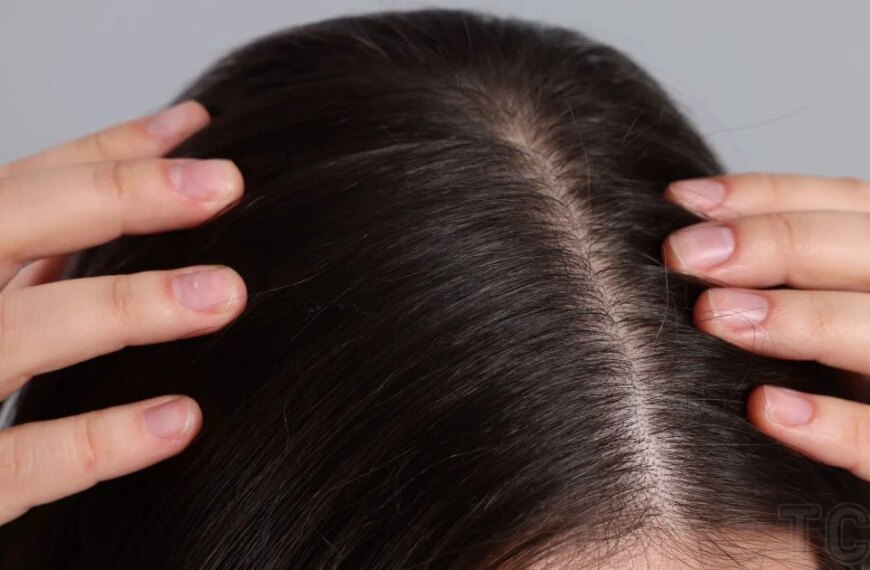 Україночка 187 Свербить шкіра голови? 12 причин, які можуть стати причиною, та як з цим боротися