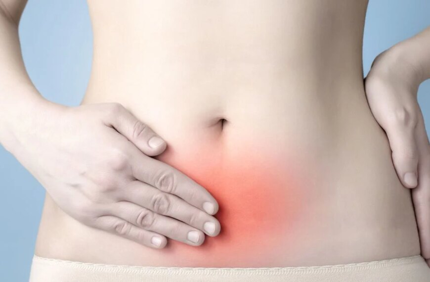 Ендометріоз: чому біль у жінки може бути не просто “жіночими” проблемами